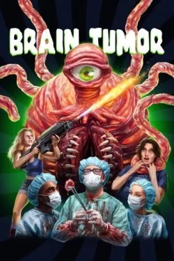 Опухоль мозга